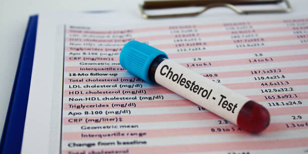 Cholesterol Blood test.